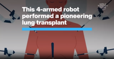 Spanish Hospital Deployed Four Armed Robot in Lung Transplant. https://innovatedstore.com